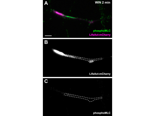 Immunofluorescence using pMLC
